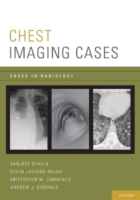 Chest Imaging Cases - Sanjeev Bhalla, Cylen Javidan-Nejad, Kristopher W. Cummings, Andrew J. Bierhals