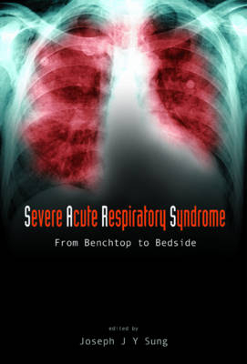 Severe Acute Respiratory Syndrome (Sars): From Benchtop To Bedside - Joseph Jao Yiu Sung