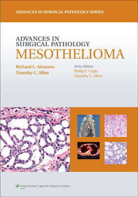 Advances in Surgical Pathology: Mesothelioma -  Attanoos, Richard Attanoos, Alain Borczuk, Francoise Galateau-Salle, Allen Gibbs