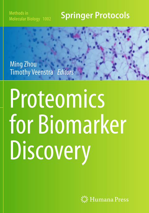 Proteomics for Biomarker Discovery - 