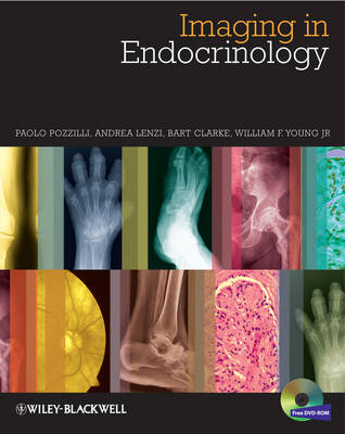 Imaging in Endocrinology - Paolo Pozzilli, Andrea Lenzi, Bart L. Clarke, William F. Young
