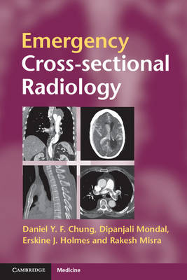 Emergency Cross-sectional Radiology - Daniel Y. F. Chung, Dipanjali Mondal, Erskine J. Holmes, Rakesh Misra