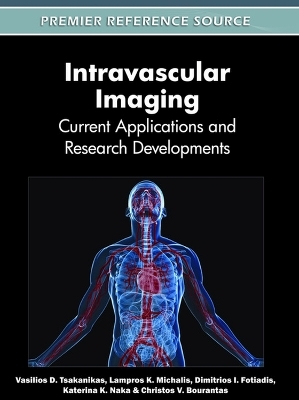 Intravascular Imaging - 