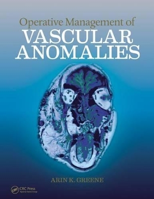 Operative Management of Vascular Anomalies - 