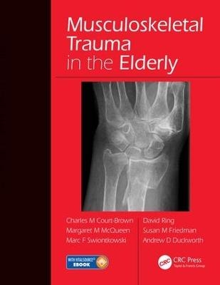 Musculoskeletal Trauma in the Elderly - 