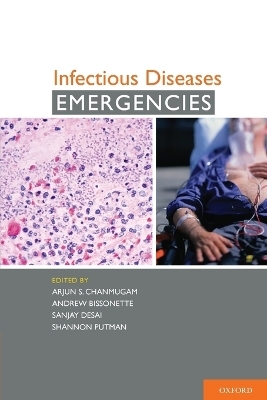 Infectious Diseases Emergencies - 