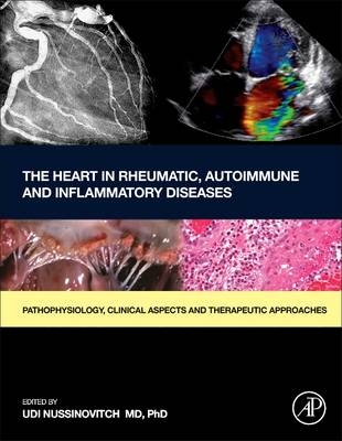 The Heart in Rheumatic, Autoimmune and Inflammatory Diseases - 