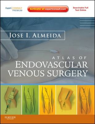 Atlas of Endovascular Venous Surgery - Jose Almeida