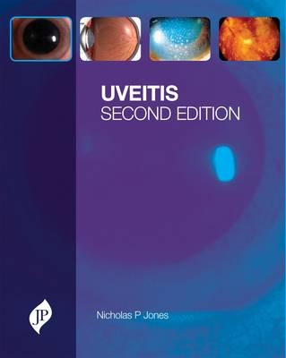 Uveitis - Nicholas P Jones