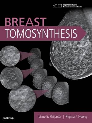 Breast Tomosynthesis - Liane E Philpotts, Regina J Hooley