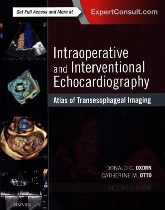 Intraoperative and Interventional Echocardiography - Donald Oxorn, Catherine M. Otto