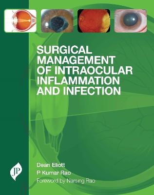 Surgical Management of Intraocular Inflammation and Infection - Dean Eliott, P Kumar Rao