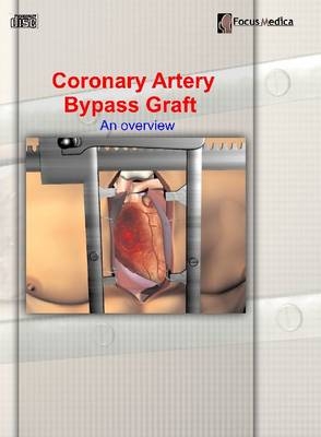 Coronary Artery Bypass Graft - 