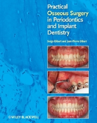 Practical Osseous Surgery in Periodontics and Implant Dentistry - Serge Dibart, Jean-Pierre Dibart