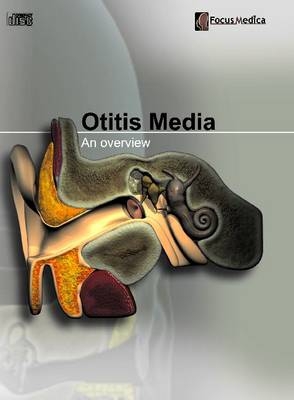 Otitis Media -  Focus Medica