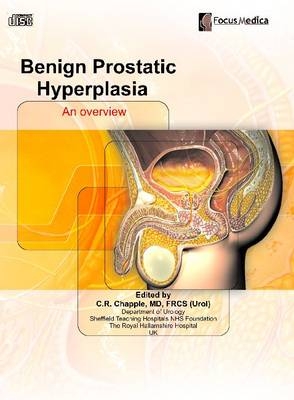 Benign Prostatic Hyperplasia - 