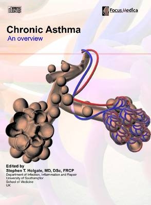 Chronic Asthma - Professor Stephen T. Holgate