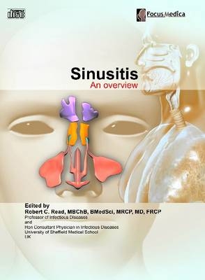 Sinusitis - 