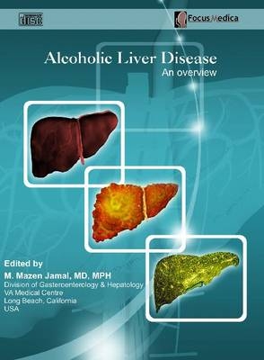 Alcoholic Liver Disease - 