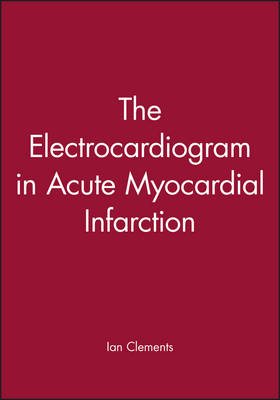 The Electrocardiogram in Acute Myocardial Infarction - 