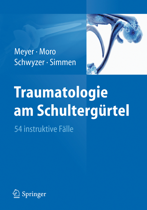 Traumatologie am Schultergürtel - Rainer-Peter Meyer, Fabrizio Moro, Hans-Kaspar Schwyzer, Beat René Simmen