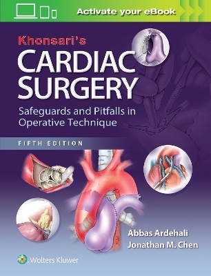 Khonsari's Cardiac Surgery: Safeguards and Pitfalls in Operative Technique - Abbas Ardehali, Jonathan M. Chen