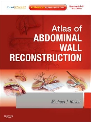 Atlas of Abdominal Wall Reconstruction - Michael J. Rosen