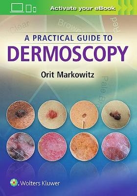 A Practical Guide to Dermoscopy - Orit Markowitz