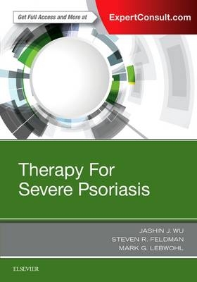 Therapy for Severe Psoriasis - Jashin J. Wu, Steven R. Feldman, Mark Lebwohl