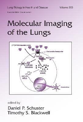 Molecular Imaging of the Lungs - 