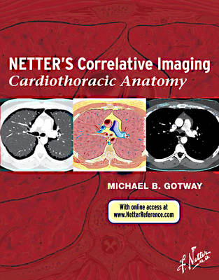 Netter's Correlative Imaging: Cardiothoracic Anatomy - Michael B. Gotway