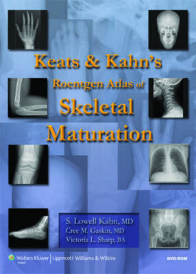Keats and Kahn's Roentgen Atlas of Skeletal Maturation - S. Lowell Kahn, Cree M. Gaskin, Victoria L. Sharp