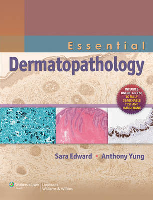 Essential Dermatopathology - Sara Edward, Anthony Yung