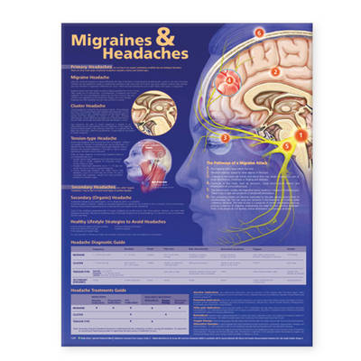 Migraines and Headaches Anatomical Chart