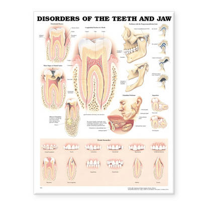 Disorders of the Teeth and Jaw Anatomical Chart