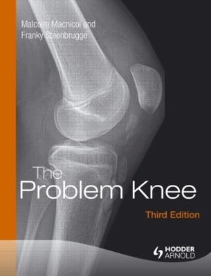 The Problem Knee - Malcolm F. Macnicol, Malcolm Macnicol, Franky Steenbrugge