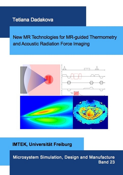 New MR Technologies for MR-guided Thermometry and Acoustic Radiation Force Imaging - Tetiana Dadakova