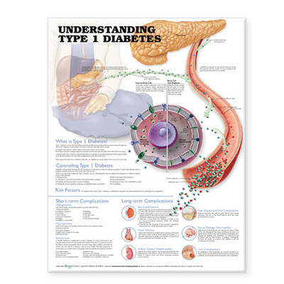 Understanding Type 1 Diabetes Anatomical Chart