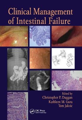 Clinical Management of Intestinal Failure - 
