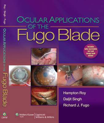 Ocular Applications of the Fugo Blade - 