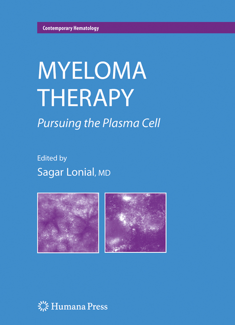 Myeloma Therapy - 