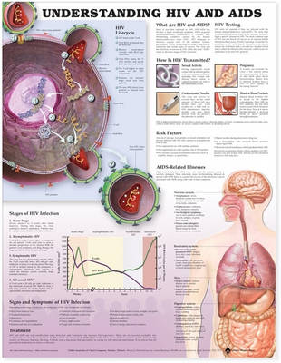 Understanding HIV and AIDS Anatomical Chart in Spanish (Entendiendo Que Son el VIH y el SIDA)