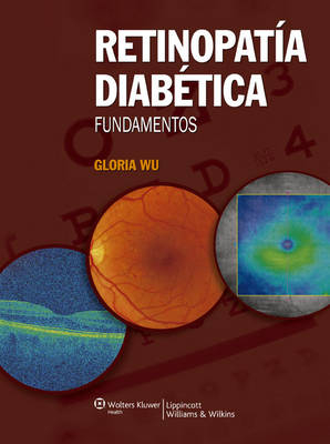 Retinopatía diabética. Fundamentos - Gloria Wu