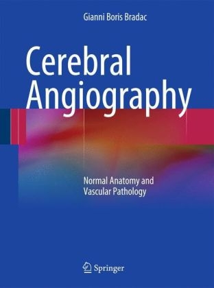 Cerebral Angiography - Gianni Boris Bradac