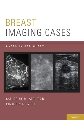 Breast Imaging Cases - Catherine M. Appleton, Kimberly N. Wiele