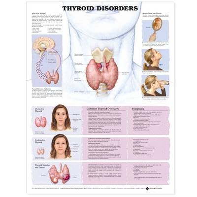 Thyroid Disorders Anatomical Chart