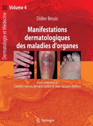 Manifestations Dermatologiques Des Maladies d'Organes - 