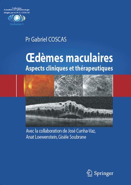 Oedèmes Maculaires - 