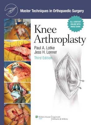 Master Techniques in Orthopaedic Surgery: Knee Arthroplasty - 
