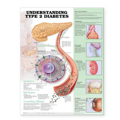 Understanding Type 2 Diabetes Anatomical Chart